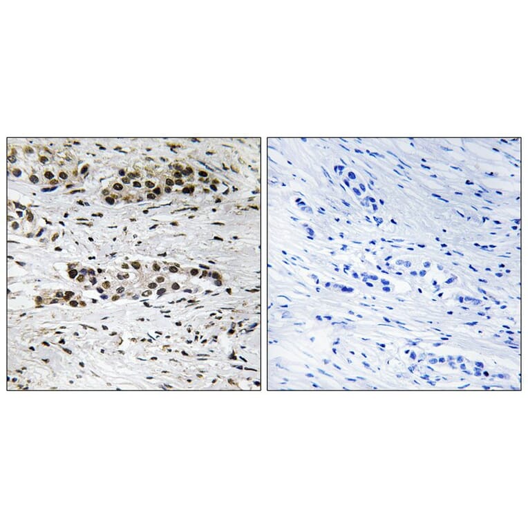 Immunohistochemistry - Estrogen Receptor-α (Phospho-Ser102) Antibody from Signalway Antibody (11801)