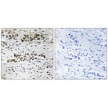 Immunohistochemistry - Estrogen Receptor-α (Phospho-Ser102) Antibody from Signalway Antibody (11801)