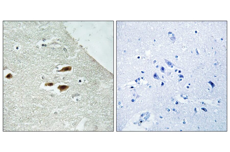 Immunohistochemistry - Period Circadian Protein 2 (Phospho-Ser662) Antibody from Signalway Antibody (12112)