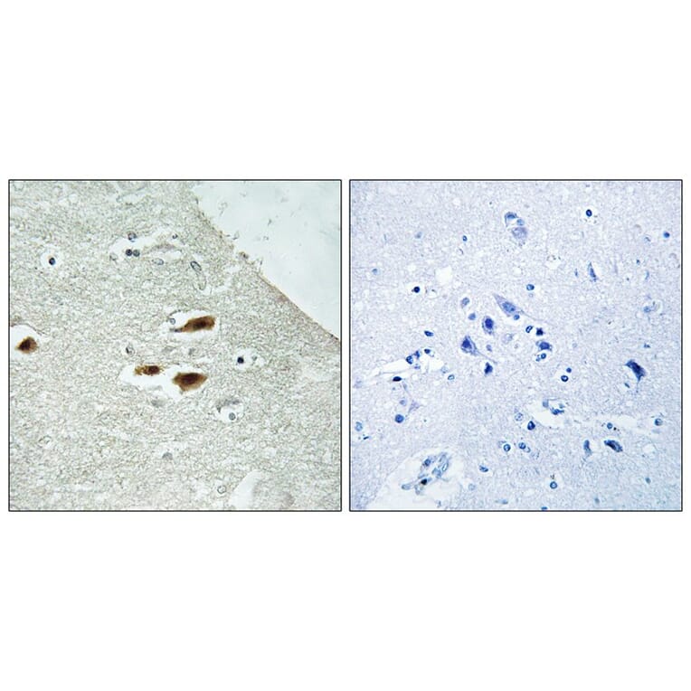 Immunohistochemistry - Period Circadian Protein 2 (Phospho-Ser662) Antibody from Signalway Antibody (12112)