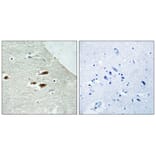 Immunohistochemistry - Period Circadian Protein 2 (Phospho-Ser662) Antibody from Signalway Antibody (12112)