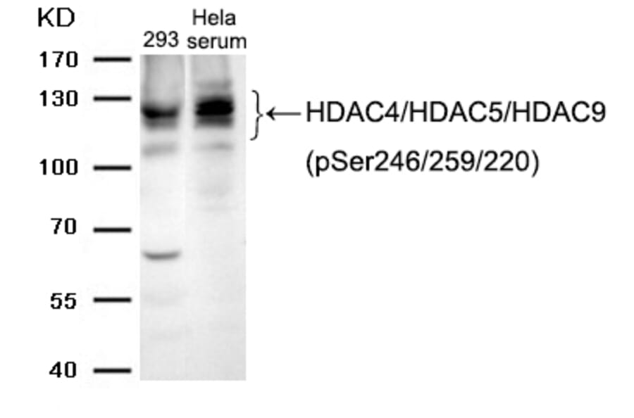 Western blot - HDAC4/HDAC5/HDAC9 (phospho-Ser246/259/220) Antibody from Signalway Antibody (11517) - Antibodies.com