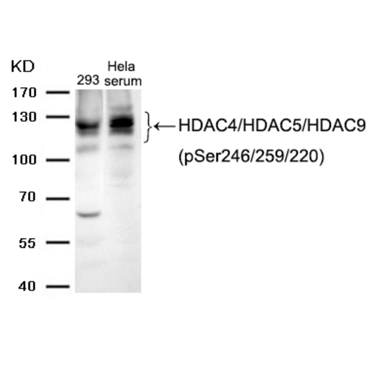 Western blot - HDAC4/HDAC5/HDAC9 (phospho-Ser246/259/220) Antibody from Signalway Antibody (11517) - Antibodies.com
