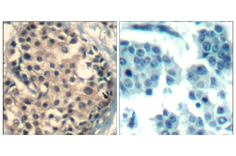 Immunohistochemistry - HDAC4/HDAC5/HDAC9 (phospho-Ser246/259/220) Antibody from Signalway Antibody (11517)