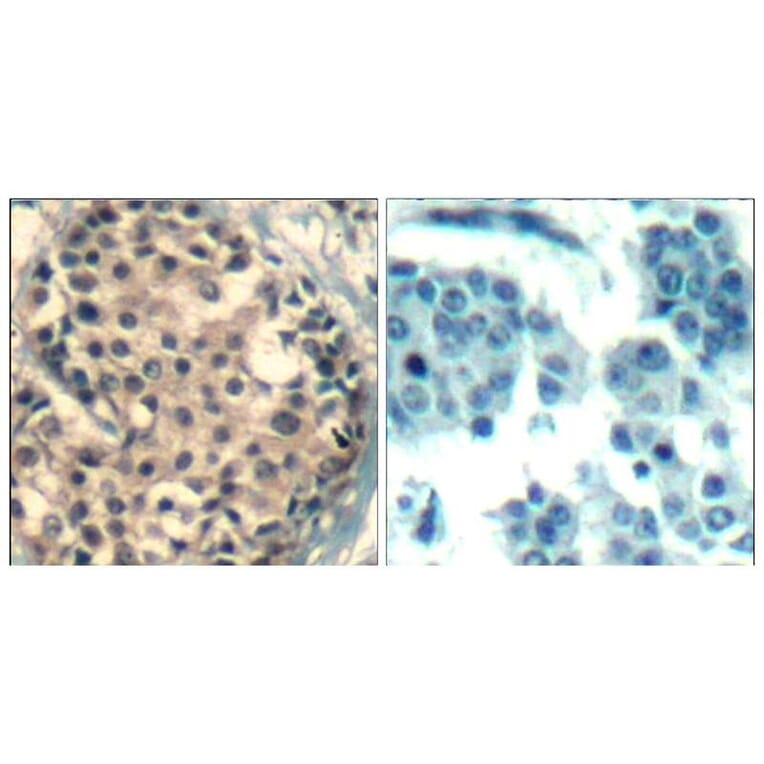 Immunohistochemistry - HDAC4/HDAC5/HDAC9 (phospho-Ser246/259/220) Antibody from Signalway Antibody (11517)