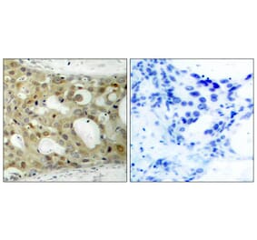 Immunohistochemistry - Androgen Receptor (Phospho-Ser650) Antibody from Signalway Antibody (11120) - Antibodies.com