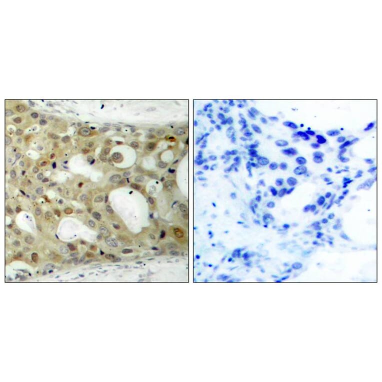 Immunohistochemistry - Androgen Receptor (Phospho-Ser650) Antibody from Signalway Antibody (11120) - Antibodies.com