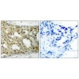 Immunohistochemistry - Androgen Receptor (Phospho-Ser650) Antibody from Signalway Antibody (11120) - Antibodies.com