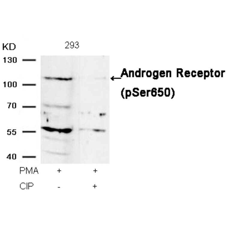 Western blot - Androgen Receptor (Phospho-Ser650) Antibody from Signalway Antibody (11120) - Antibodies.com