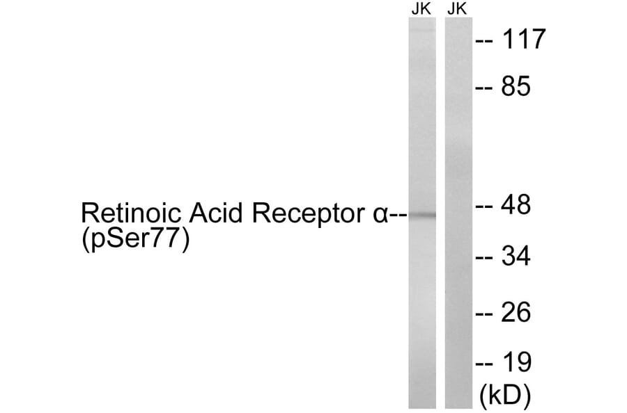 Western blot - Retinoic Acid Receptor α (Phospho-Ser77) Antibody from Signalway Antibody - Antibodies.com