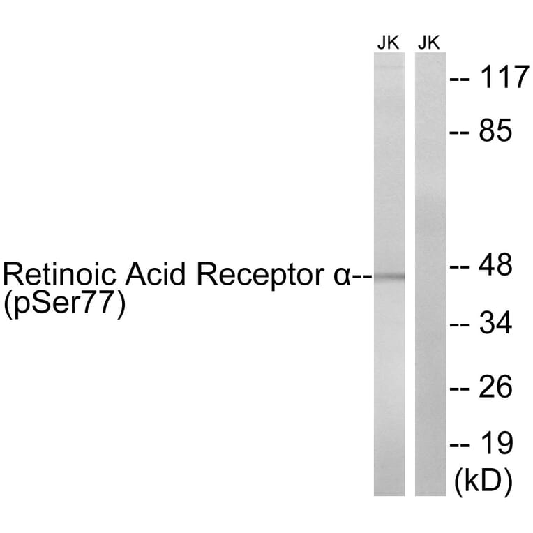 Western blot - Retinoic Acid Receptor α (Phospho-Ser77) Antibody from Signalway Antibody - Antibodies.com