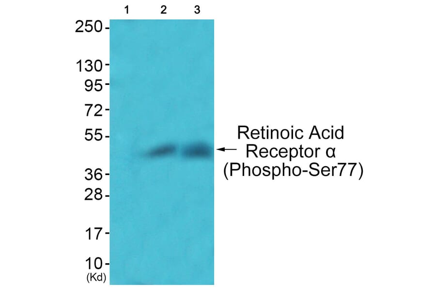Western blot - Retinoic Acid Receptor α (Phospho-Ser77) Antibody from Signalway Antibody - Antibodies.com