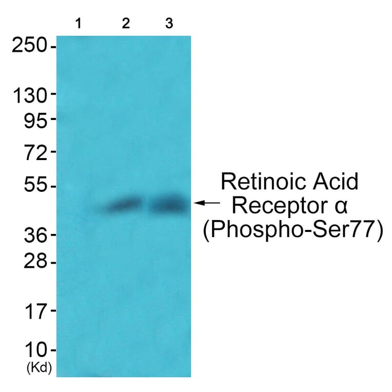 Western blot - Retinoic Acid Receptor α (Phospho-Ser77) Antibody from Signalway Antibody - Antibodies.com