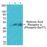 Western blot - Retinoic Acid Receptor α (Phospho-Ser77) Antibody from Signalway Antibody - Antibodies.com