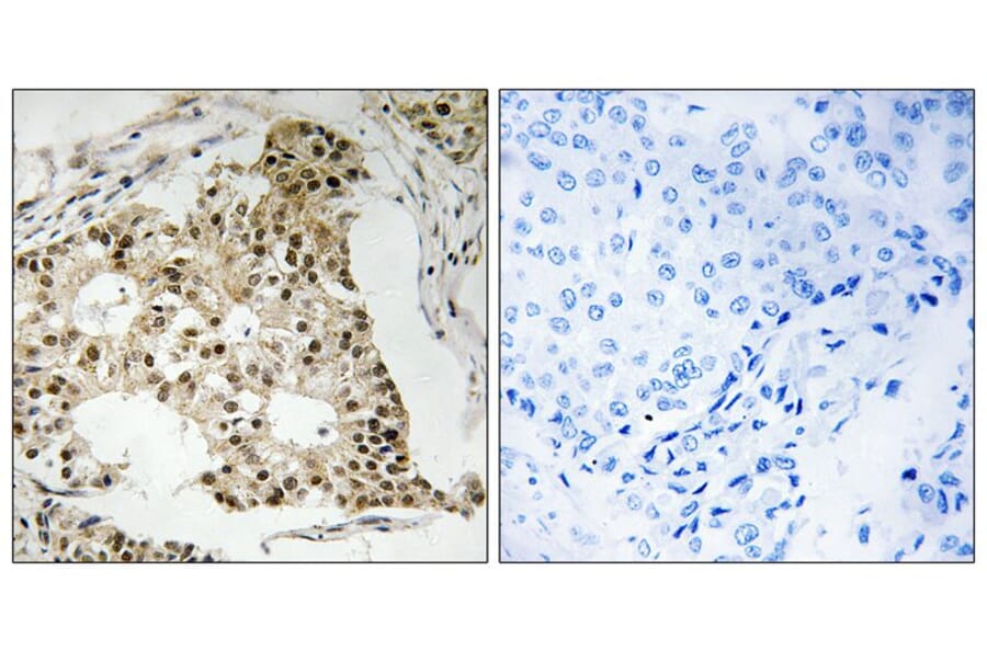 Immunohistochemistry - Retinoic Acid Receptor α (Phospho-Ser77) Antibody from Signalway Antibody (12121)