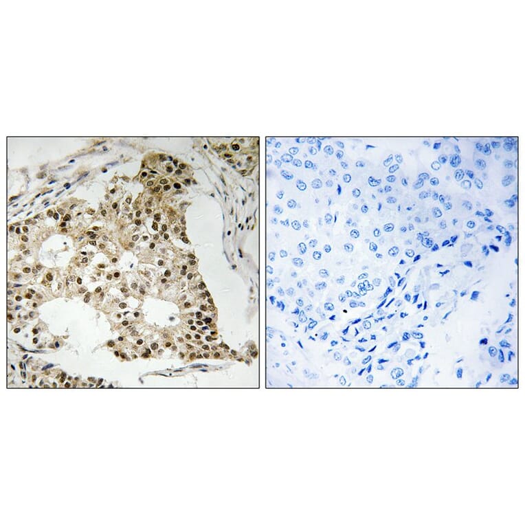 Immunohistochemistry - Retinoic Acid Receptor α (Phospho-Ser77) Antibody from Signalway Antibody (12121)