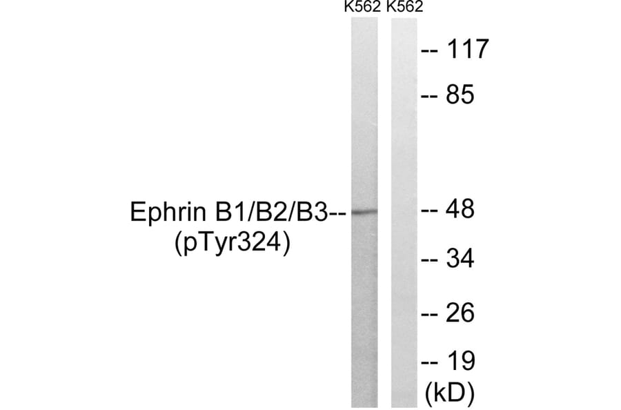 Western blot - Ephrin B1/B2/B3 (Phospho-Tyr324) Antibody from Signalway Antibody (11780) - Antibodies.com