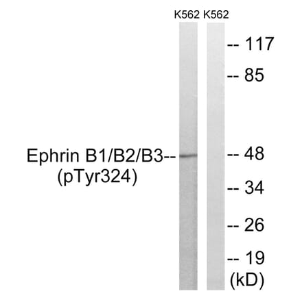 Western blot - Ephrin B1/B2/B3 (Phospho-Tyr324) Antibody from Signalway Antibody (11780) - Antibodies.com