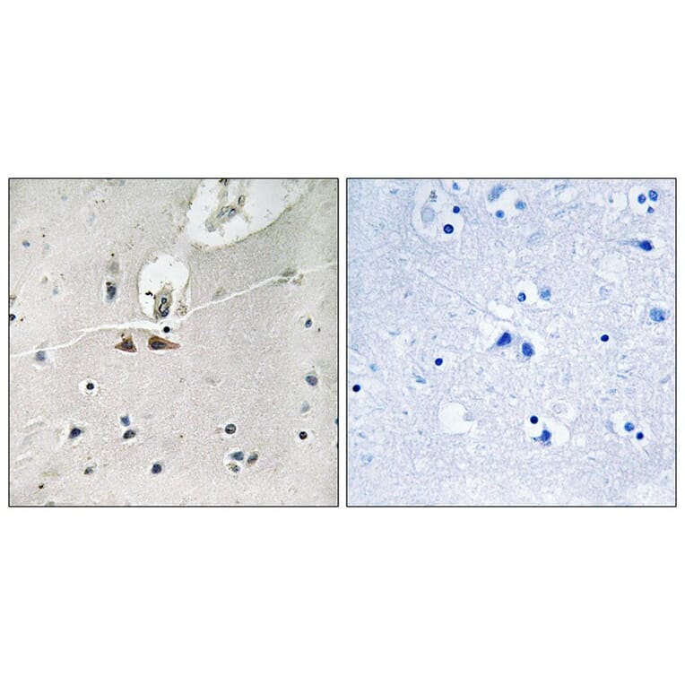 Immunohistochemistry - Ephrin B1/B2/B3 (Phospho-Tyr324) Antibody from Signalway Antibody (11780) - Antibodies.com