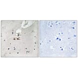 Immunohistochemistry - Ephrin B1/B2/B3 (Phospho-Tyr324) Antibody from Signalway Antibody (11780) - Antibodies.com