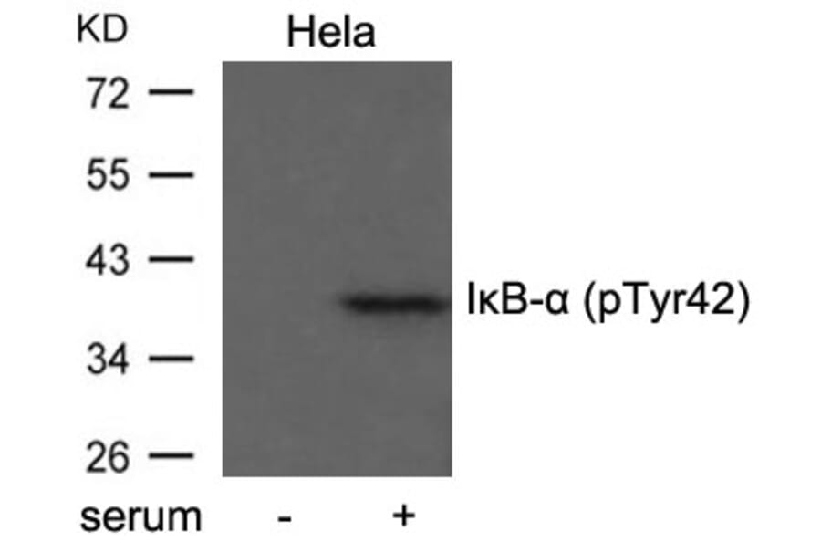 Western blot - IkB-a (Phospho-Tyr42) Antibody from Signalway Antibody (11162) - Antibodies.com