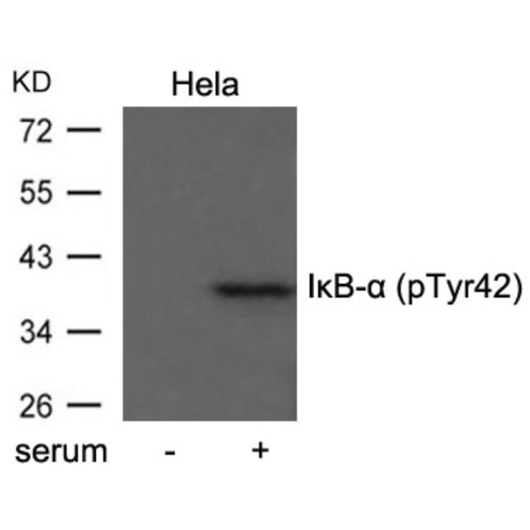 Western blot - IkB-a (Phospho-Tyr42) Antibody from Signalway Antibody (11162) - Antibodies.com