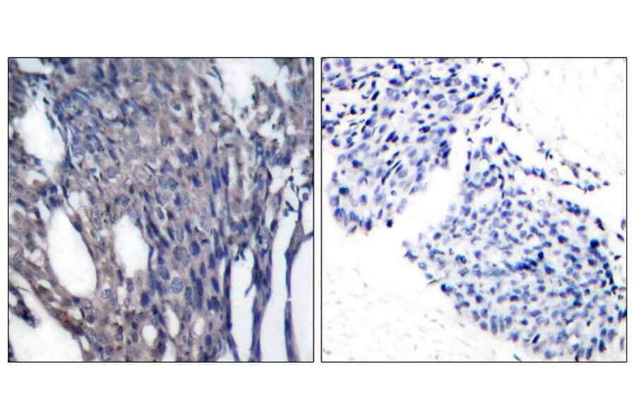 Immunohistochemistry - IkB-a (Phospho-Tyr42) Antibody from Signalway Antibody (11162) - Antibodies.com