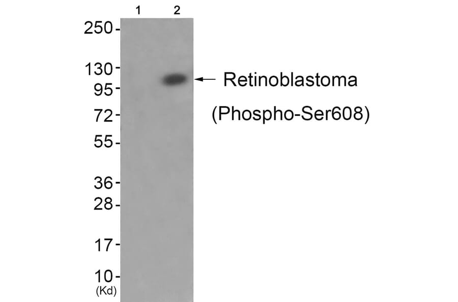 Western blot - Retinoblastoma (Phospho-Ser608) Antibody from Signalway Antibody (11720) - Antibodies.com