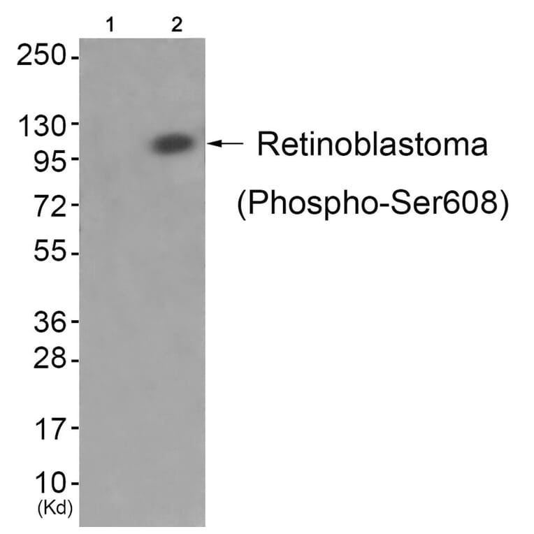 Western blot - Retinoblastoma (Phospho-Ser608) Antibody from Signalway Antibody (11720) - Antibodies.com