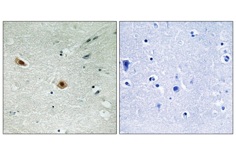 Immunohistochemistry - Retinoblastoma (Phospho-Ser608) Antibody from Signalway Antibody (11720) - Antibodies.com