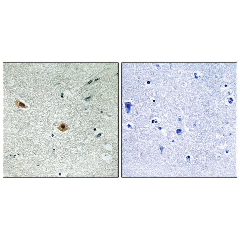 Immunohistochemistry - Retinoblastoma (Phospho-Ser608) Antibody from Signalway Antibody (11720) - Antibodies.com