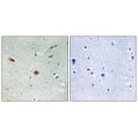 Immunohistochemistry - Retinoblastoma (Phospho-Ser608) Antibody from Signalway Antibody (11720) - Antibodies.com