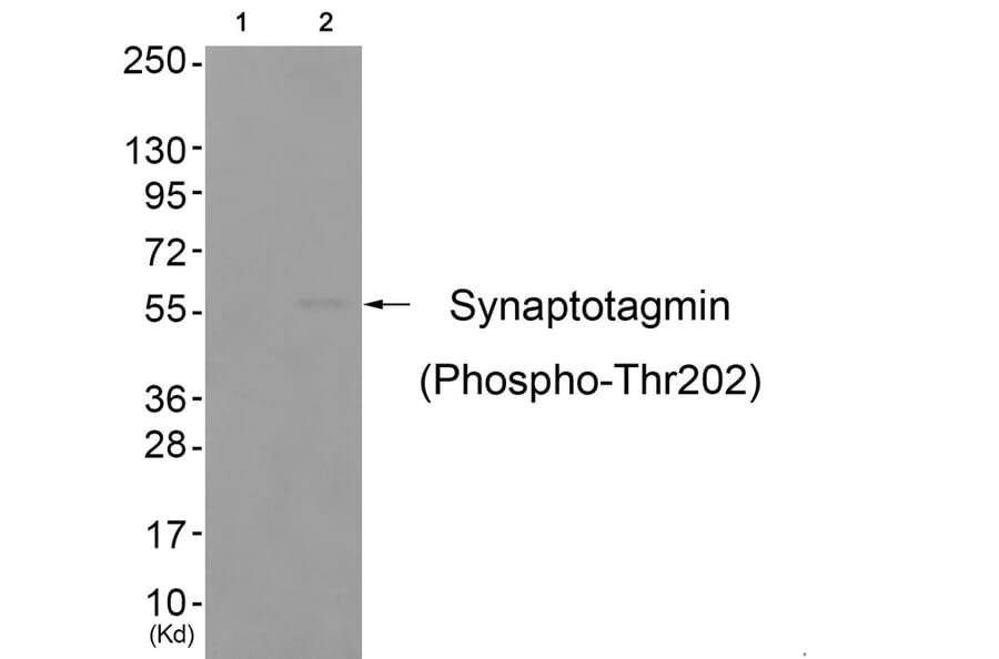 Western blot - Synaptotagmin (Phospho-Thr202) Antibody from Signalway Antibody (11645) - Antibodies.com