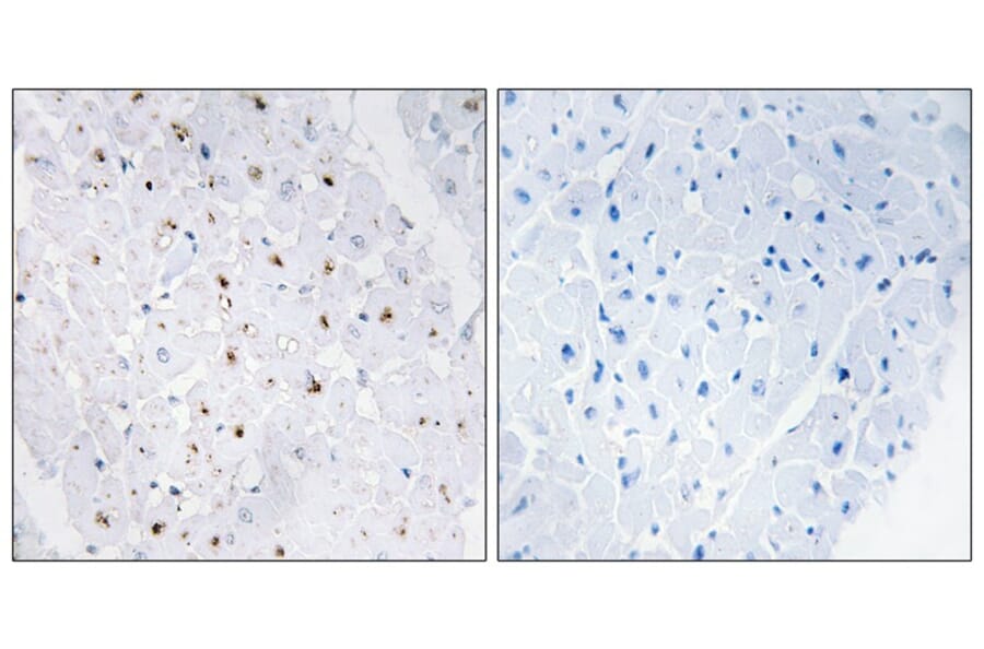 Immunohistochemistry - Bloom Syndrome (Phospho-Thr99) Antibody from Signalway Antibody (11681) - Antibodies.com