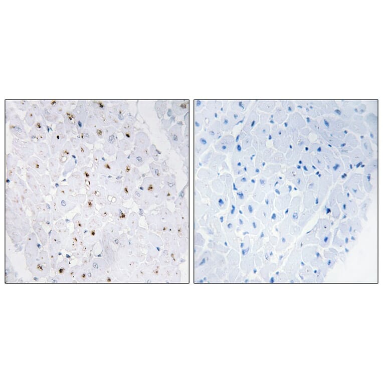 Immunohistochemistry - Bloom Syndrome (Phospho-Thr99) Antibody from Signalway Antibody (11681) - Antibodies.com