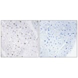 Immunohistochemistry - Bloom Syndrome (Phospho-Thr99) Antibody from Signalway Antibody (11681) - Antibodies.com