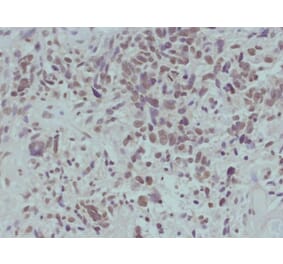 Immunohistochemistry - beta-catenin (Phospho-Ser715) Antibody from Signalway Antibody (11594) - Antibodies.com
