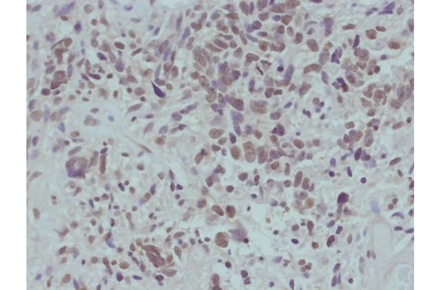 Immunohistochemistry - beta-catenin (Phospho-Ser715) Antibody from Signalway Antibody (11594) - Antibodies.com