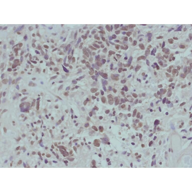 Immunohistochemistry - beta-catenin (Phospho-Ser715) Antibody from Signalway Antibody (11594) - Antibodies.com