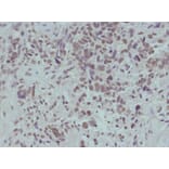 Immunohistochemistry - beta-catenin (Phospho-Ser715) Antibody from Signalway Antibody (11594) - Antibodies.com