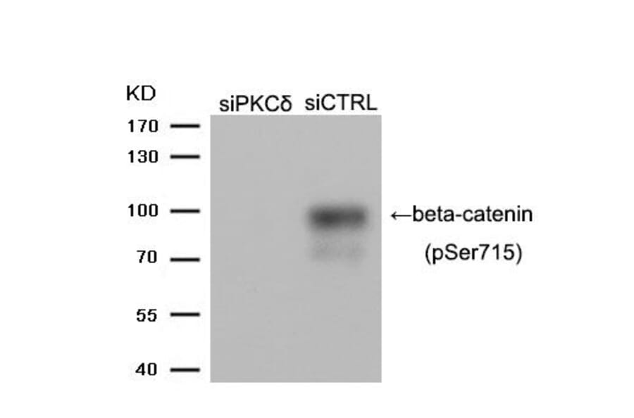 Western blot - beta-catenin (Phospho-Ser715) Antibody from Signalway Antibody (11594) - Antibodies.com
