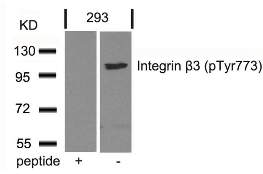 Western blot - Integrin b3 (Phospho-Tyr773) Antibody from Signalway Antibody (11060) - Antibodies.com