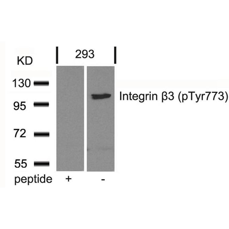 Western blot - Integrin b3 (Phospho-Tyr773) Antibody from Signalway Antibody (11060) - Antibodies.com