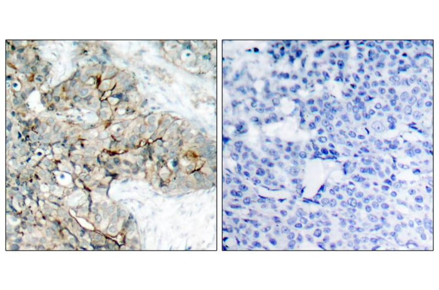 Immunohistochemistry - Integrin b3 (Phospho-Tyr773) Antibody from Signalway Antibody (11060) - Antibodies.com