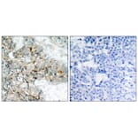 Immunohistochemistry - Integrin b3 (Phospho-Tyr773) Antibody from Signalway Antibody (11060) - Antibodies.com