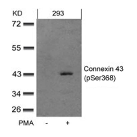 Western blot - Connexin 43 (phospho-Ser368) Antibody from Signalway Antibody (11258) - Antibodies.com