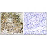 Immunohistochemistry - Integrin β1 (Phospho-Thr789) Antibody from Signalway Antibody (11661) - Antibodies.com