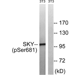 Western blot - MER/SKY (Phospho-Tyr749/681) Antibody from Signalway Antibody (11740) - Antibodies.com