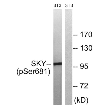 Western blot - MER/SKY (Phospho-Tyr749/681) Antibody from Signalway Antibody (11740) - Antibodies.com