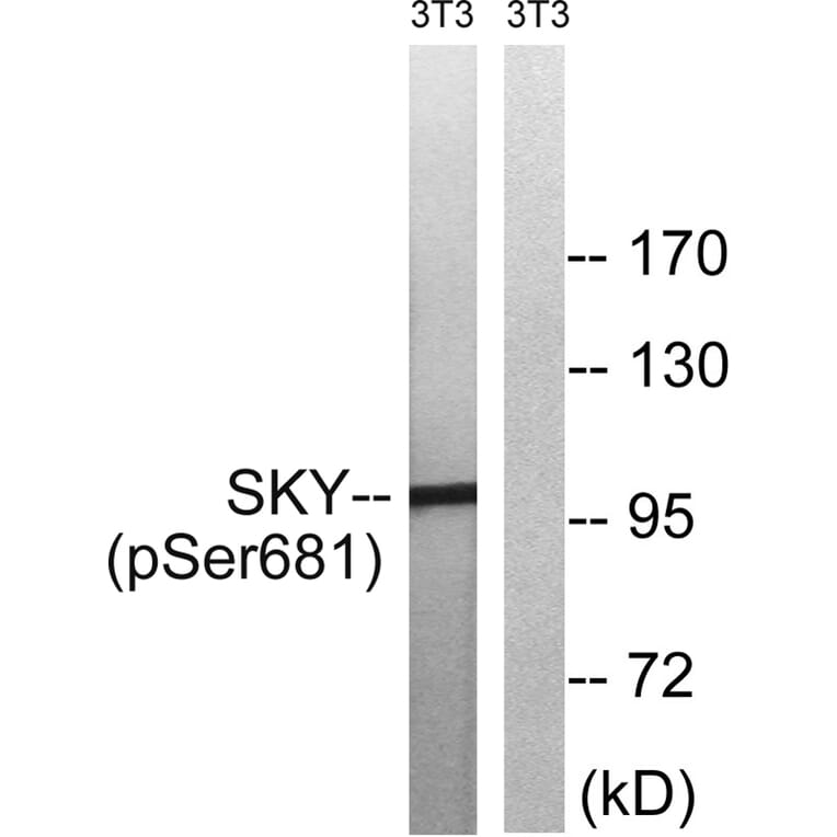 Western blot - MER/SKY (Phospho-Tyr749/681) Antibody from Signalway Antibody (11740) - Antibodies.com